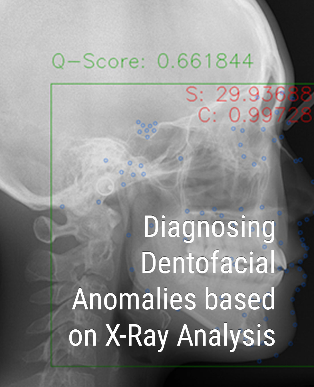 Diagnosing Dentofacial Anomalies based on X-Ray Analysis
